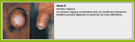 ISAGRI - 2021 - Evaluation du trayon stade R - 0121