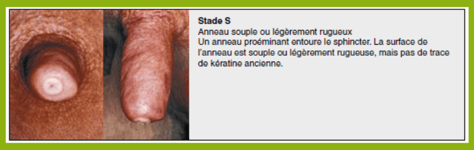 ISAGRI - 2021 - Evaluation du trayon stade s - 0121